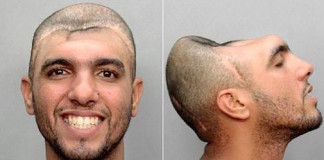 Extraño caso de «hombre con media cabeza»