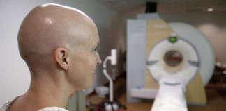 Nueva técnica contra el cáncer evita efectos de la quimioterapia