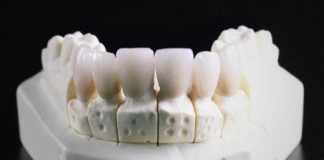 Crean Dientes con impresión 3D que serán Antibacterianos