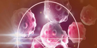 Investigadores hallan un mecanismo para reducir la recurrencia del cáncer de mama