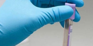 Cáncer de colon podrá detectarse con una prueba de sangre