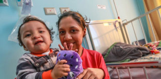 UPAO y Global Smile operarán gratis a pacientes de labio leporino