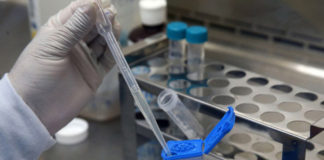 Desarrollan prueba sanguínea que diagnostica la tuberculosis en pocas horas