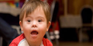 Tratamiento para síntomas intelectuales de Síndrome de Down