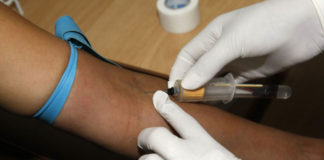 Examen simple de sangre permite detectar Leucemia