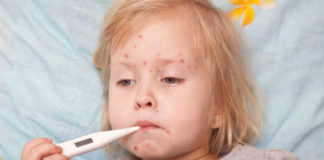 Prevención y tratamiento contra la varicela