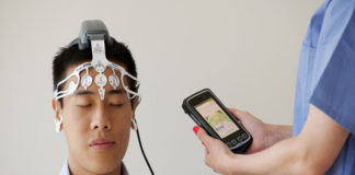 Crean nuevo método para diagnosticar las conmociones cerebrales