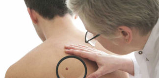 Sobreexposición a los rayos ultravioleta puede causar cáncer