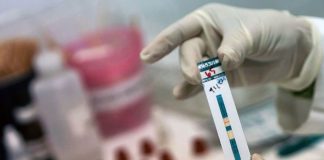 ONU reconoce reducción de la mortalidad por sida en el Perú