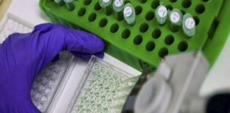 Investigan Hongo Intestinal que podría ayudar a detectar riesgo cardiovascular