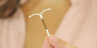 Estudio revela que la ‘T de cobre’ disminuye el riesgo de cáncer de cuello uterino