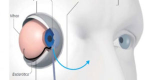 Peruano patenta técnica para el tratamiento del glaucoma en EE.UU.