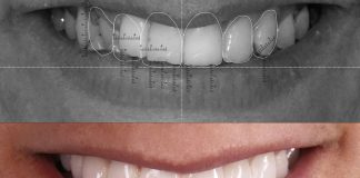 ¿Qué es la odontología restauradora?