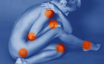 ¿Qué es la bursitis y cómo afecta a tu actividad física?