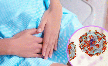 ¿Qué es una vaginitis bacteriana?