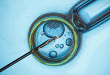 ¿Qué es la fecundación in vitro?