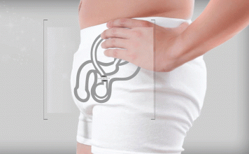 ¿Qué es la vasectomia?
