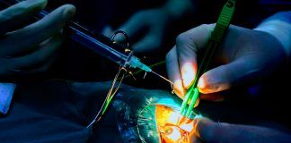 Essalud ejecuta operaciones de cirugía de cataratas con el plan «Volver a ver»