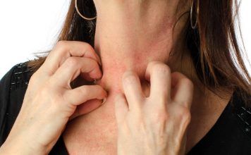 ¿Qué es y qué se debe hacer en caso de una intoxicación?