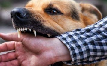 ¿Qué hacer ante una mordedura de perro?